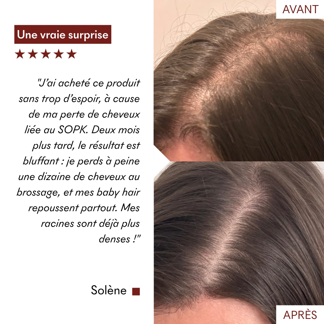 Serum Croissance Tricho-Boost — vue 17