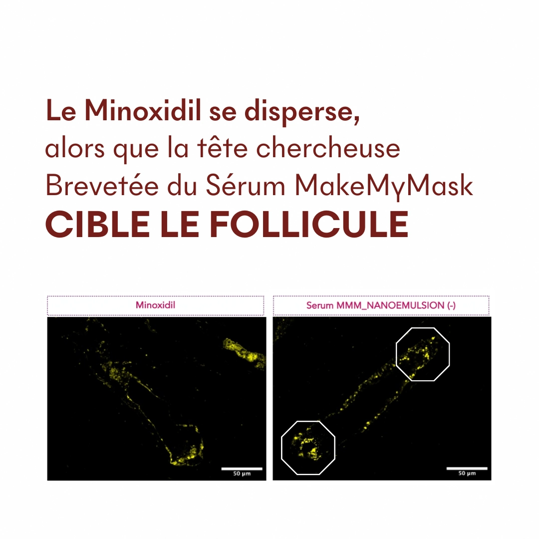 Serum Croissance Tricho-Boost — vue 9