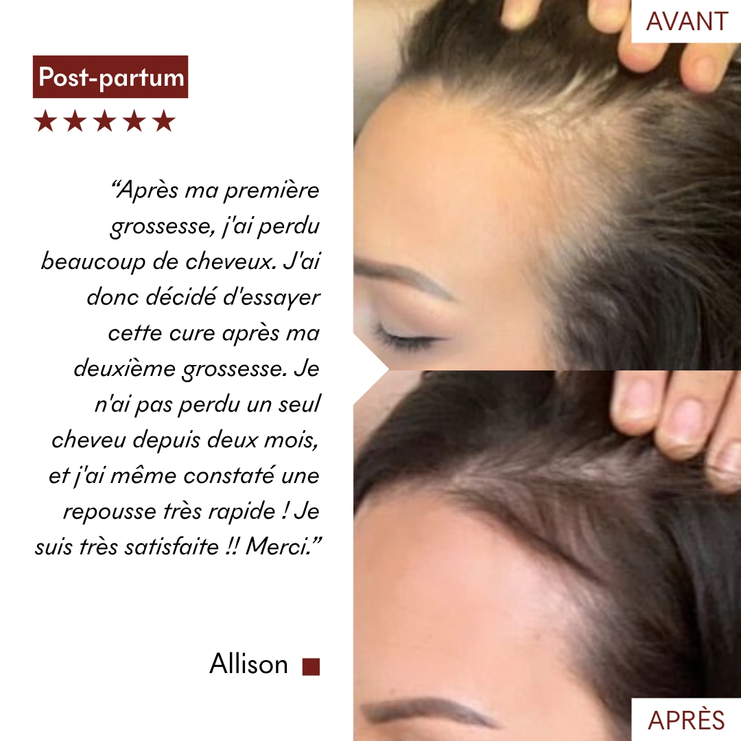 Serum Croissance Tricho-Boost — vue 16