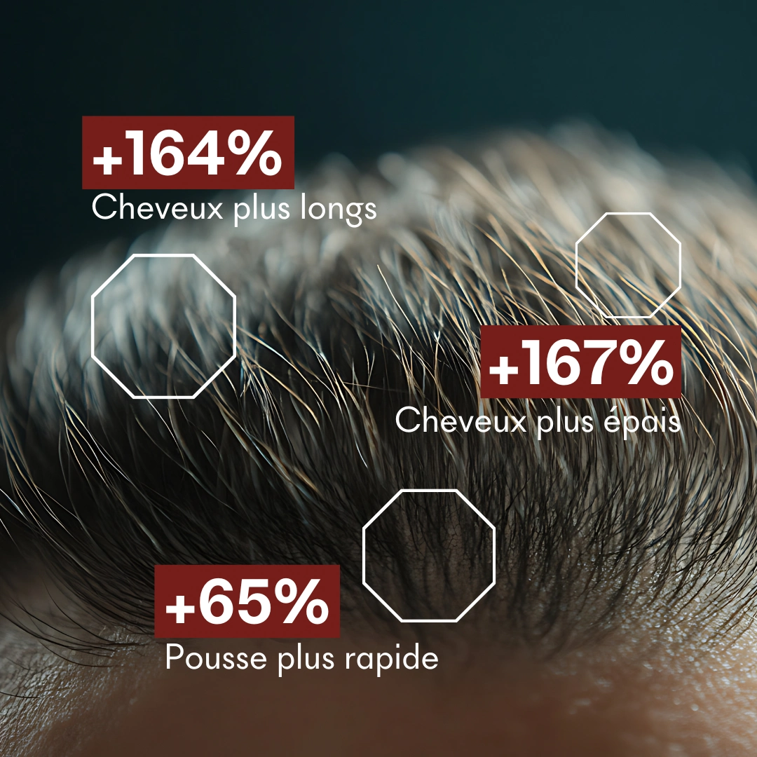Serum Croissance Tricho-Boost — vue 18
