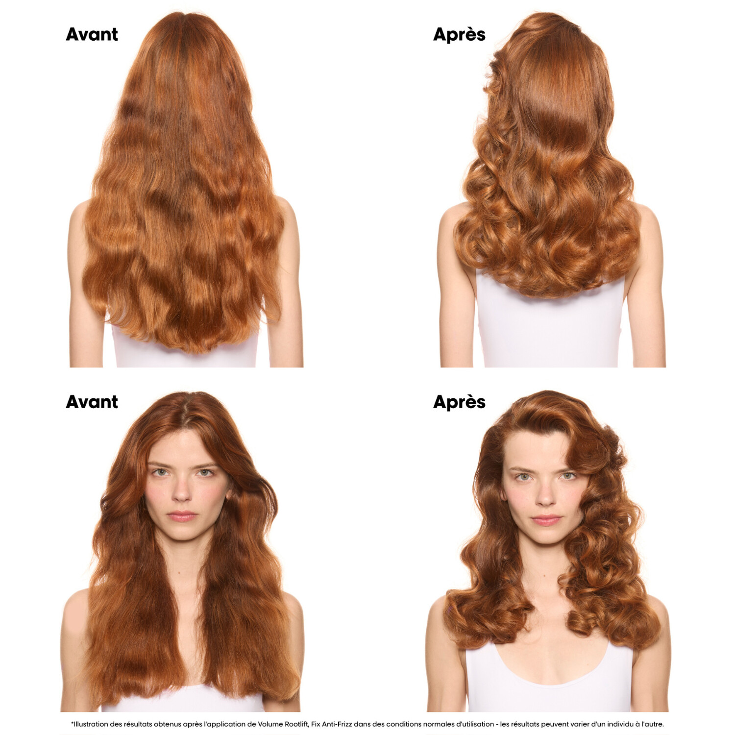 Volume Rootlift – Tecni Art — vue 5