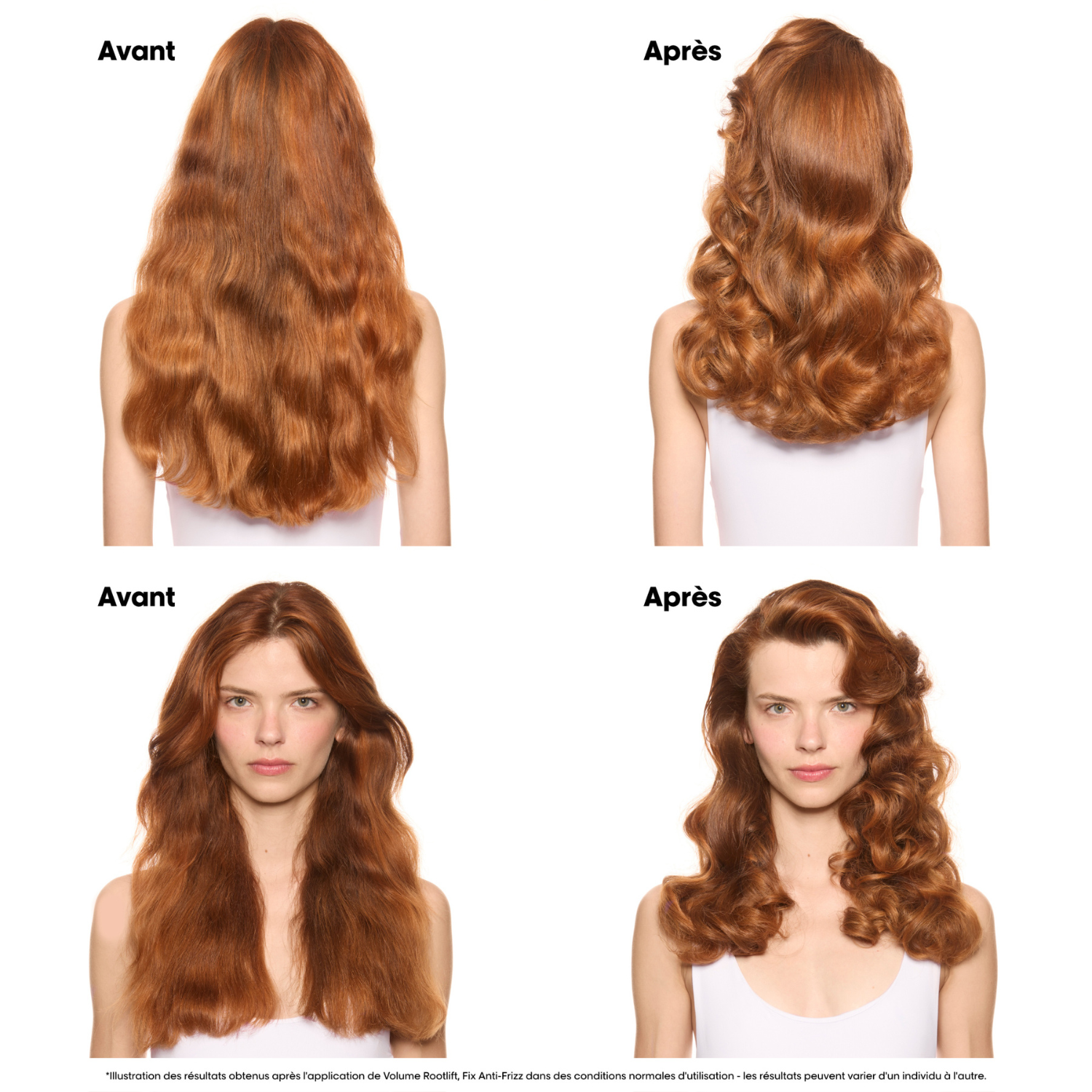 Volume Rootlift – Tecni Art — vue 5