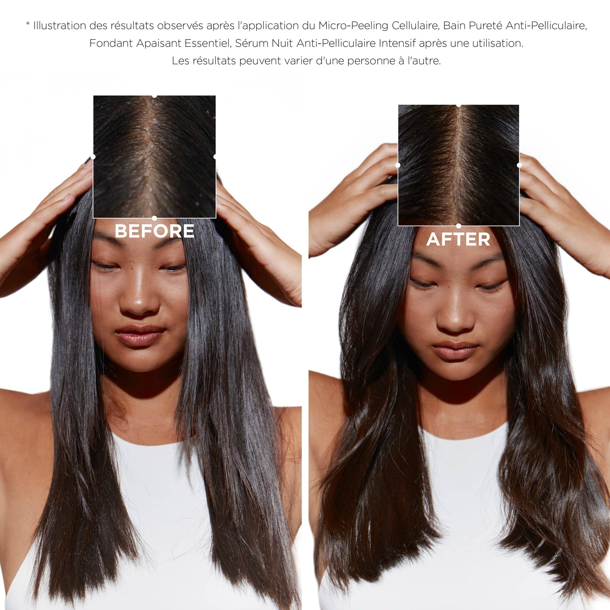 Micro-Peeling Cellulaire — vue 3