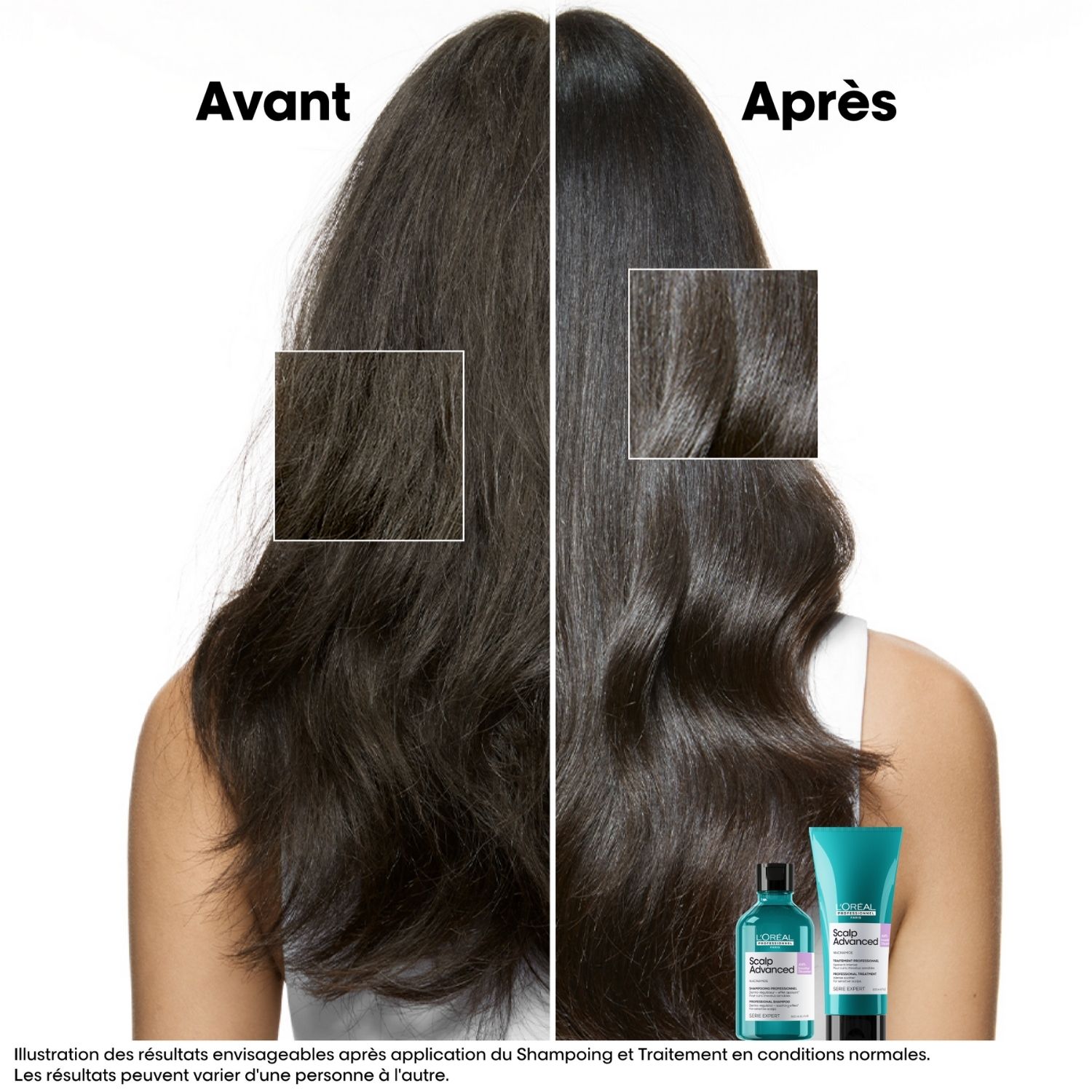 Refill – Serie Expert Scalp Advanced — vue 3