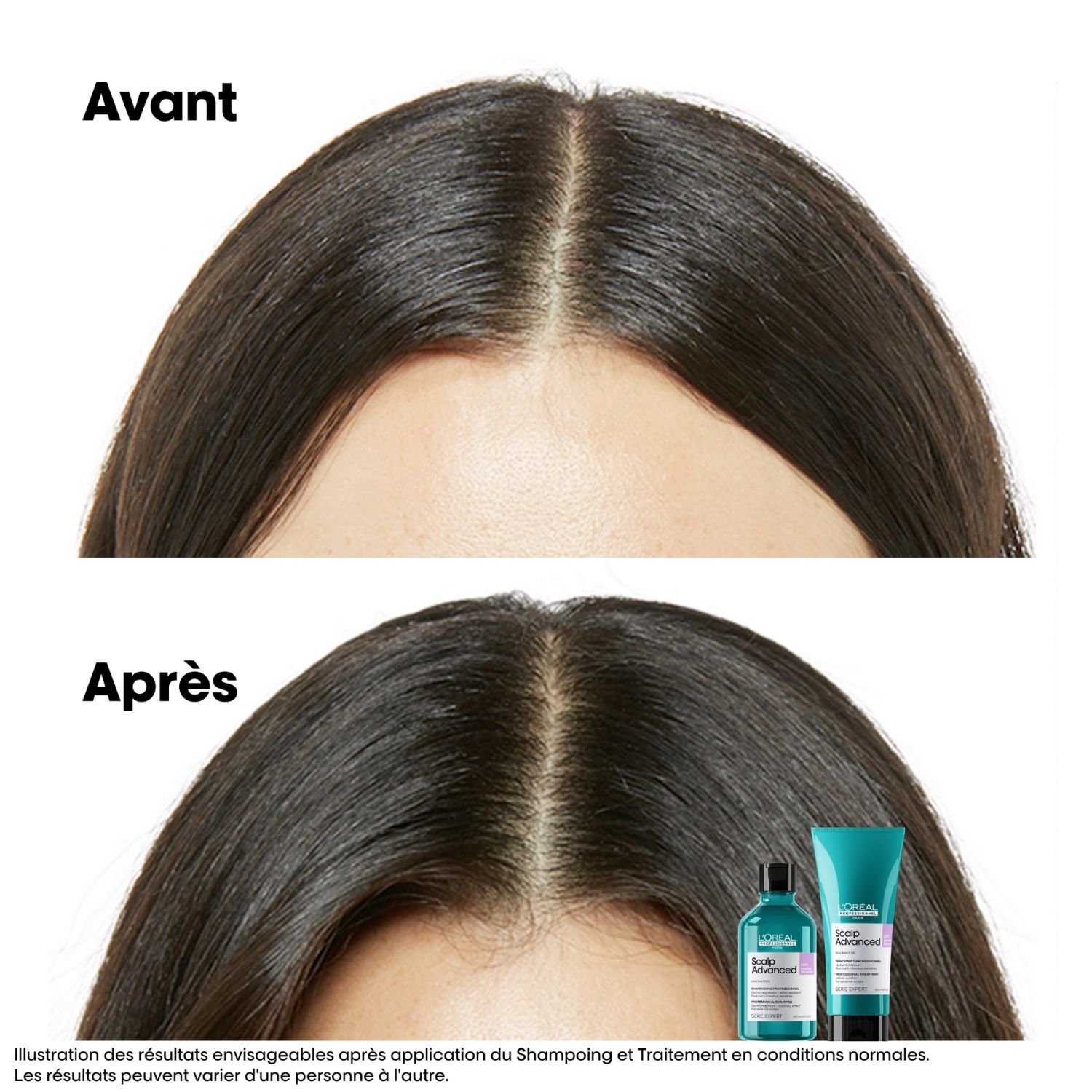 Refill – Serie Expert Scalp Advanced — vue 4
