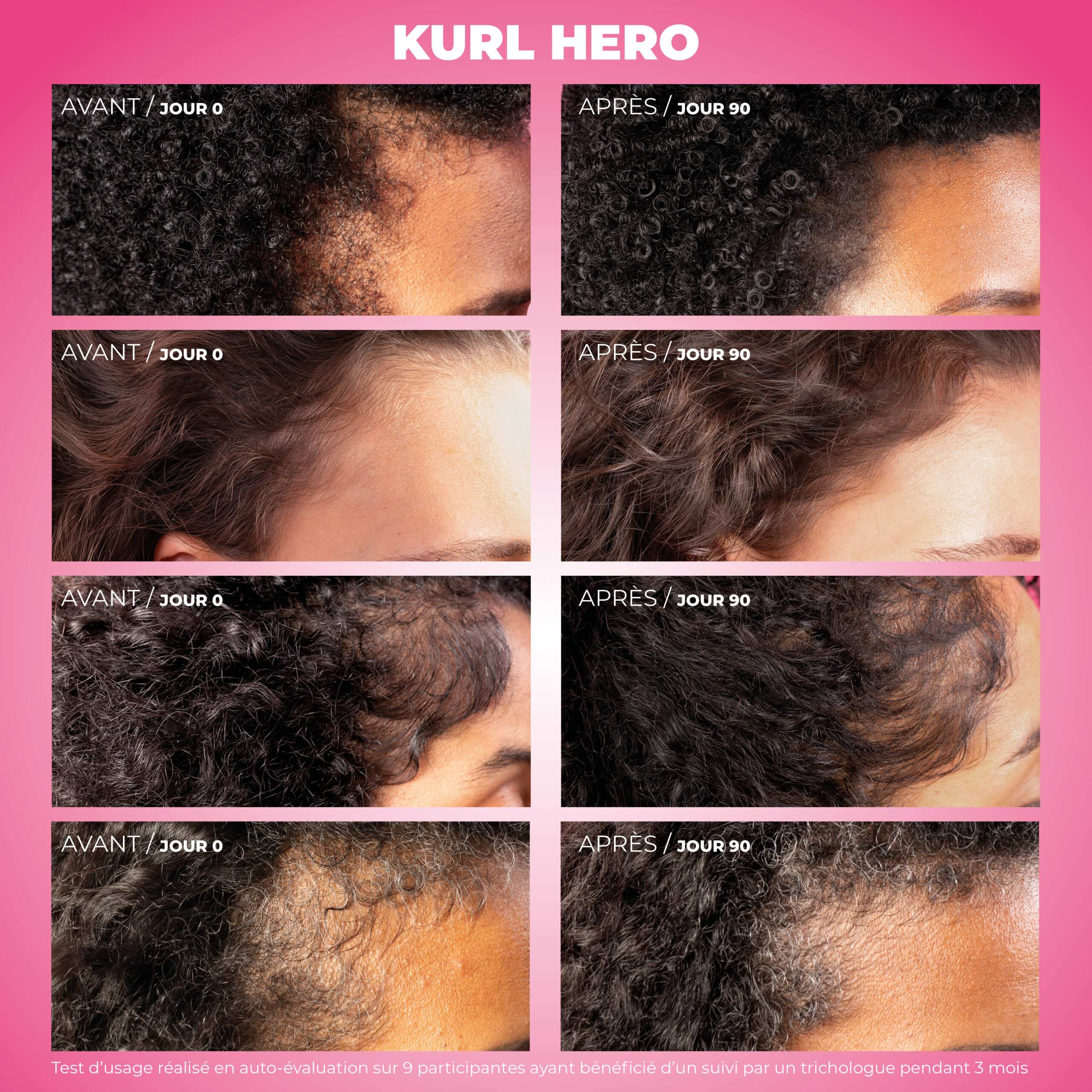 Résultats avant/après l'utilisation du sérum anti-chute Kurl Hero Les Secrets de Loly — vue 5