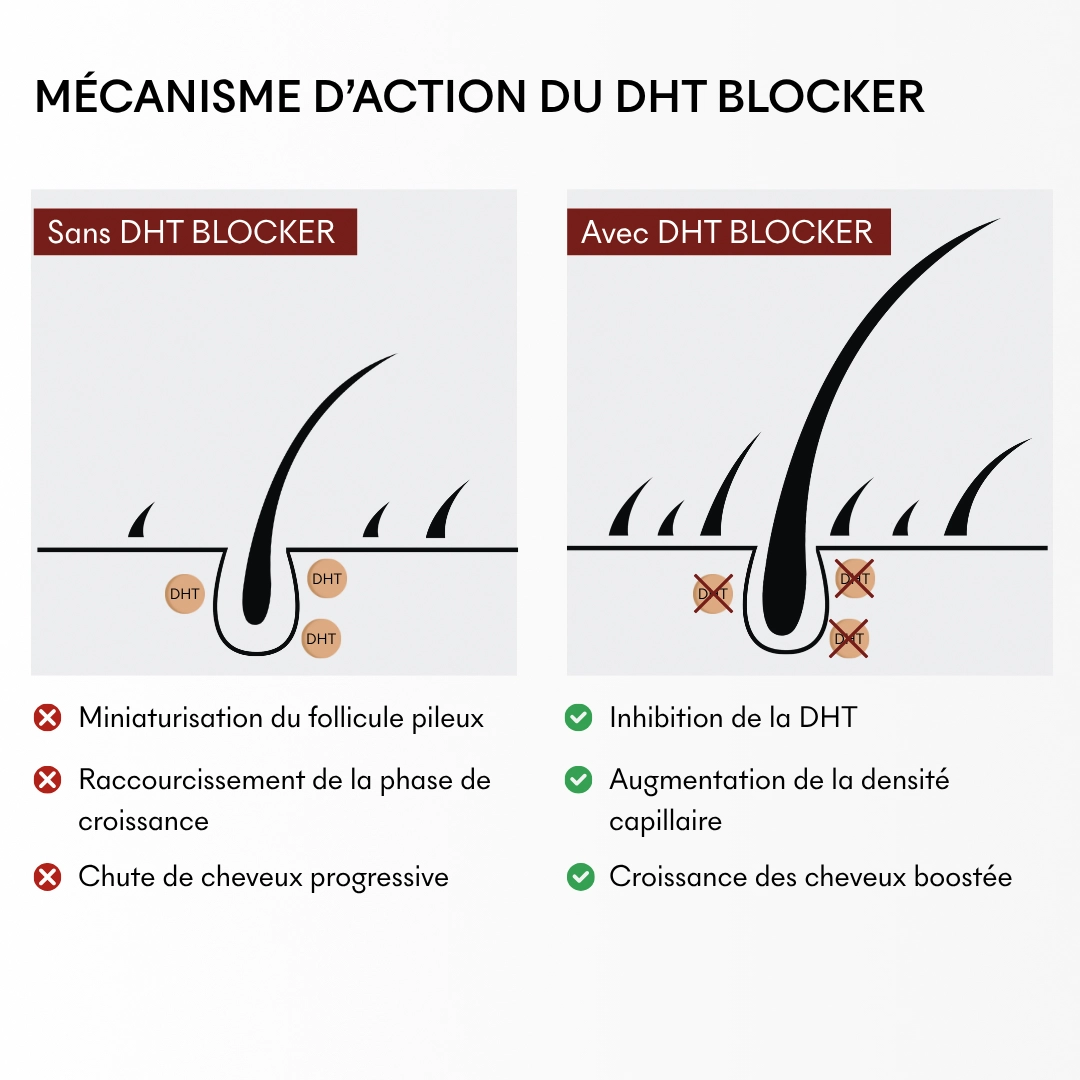 Compléments alimentaires anti-chute hormonale — vue 5