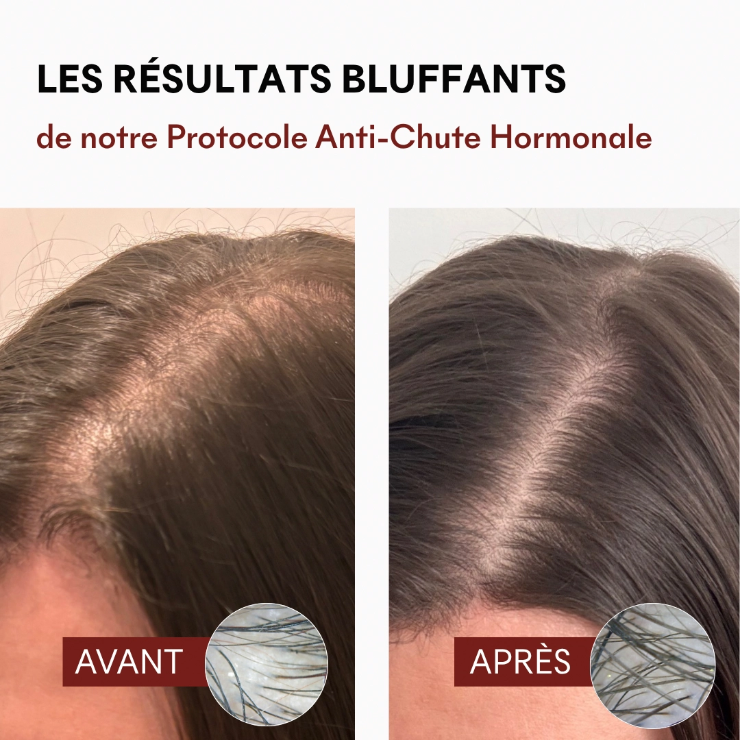 Compléments alimentaires anti-chute hormonale — vue 9