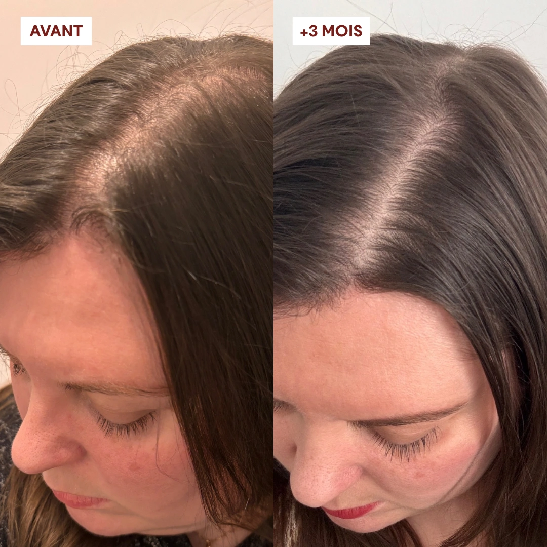 Gommage Actif Anti-Chute Make my Mask — vue 6