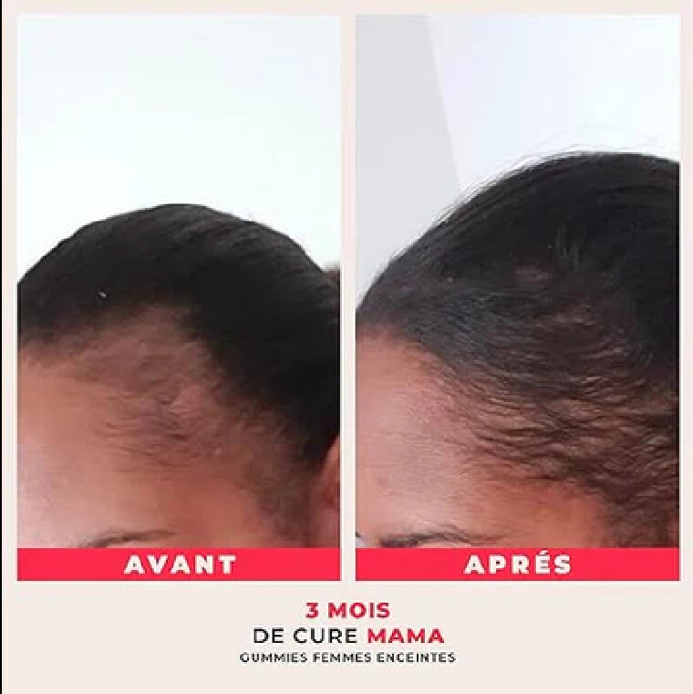 Mama — vue 7